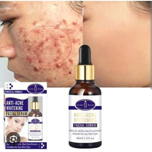 Aichun Beauty Medical Formula Anti-acne Whitening Facial Serum