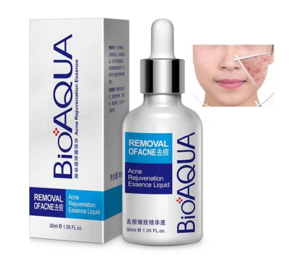 Bioaqua Anti-acne Serum Removal Of Acne Essence Liquid