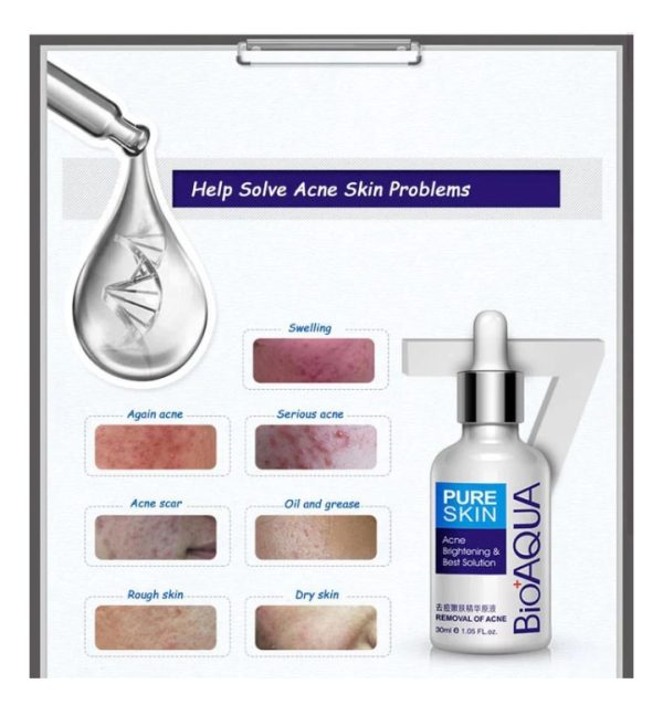 Bioaqua Anti-acne Serum Removal Of Acne Essence Liquid