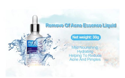 Bioaqua Anti-acne Serum Removal Of Acne Essence Liquid